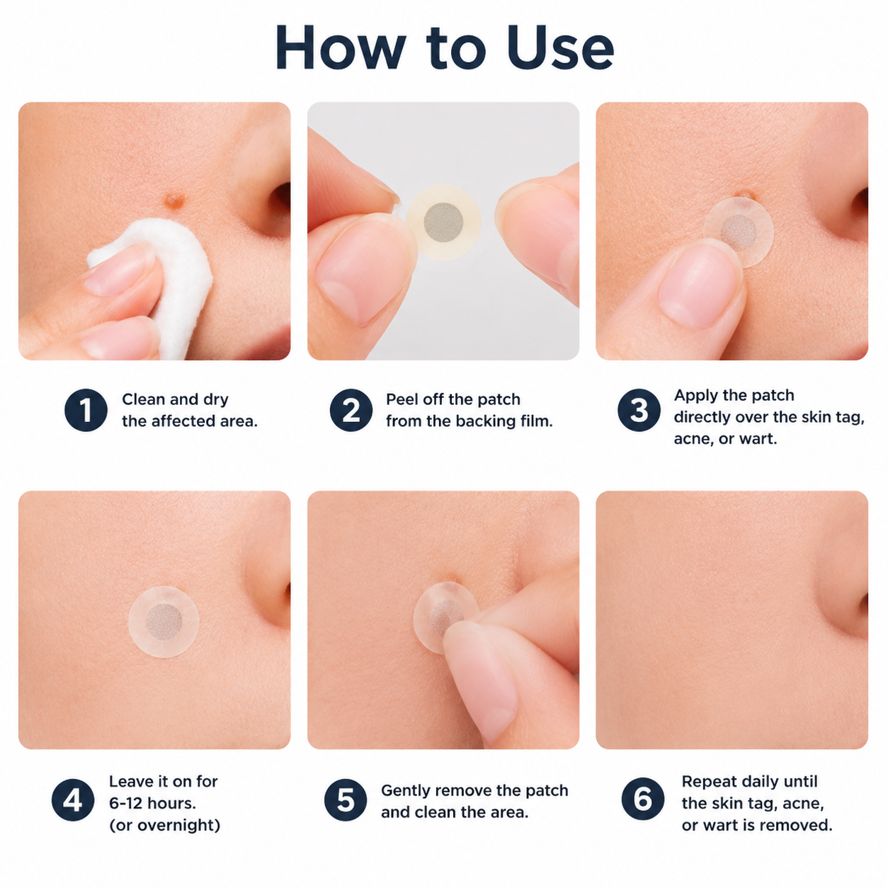 ✨Elmstr®2-in-1 Microneedle & Hydrocolloid Patch🍀| Removes Raised Moles, Acne, Flat Warts & Skin Tags | Helps Improve Wrinkles, Scars & Blemishes | Invisible Patches for Face & Body