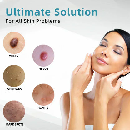 ✨All-in-One CO₂ Laser Eraser Pen | Removes Moles, Warts, Skin Flaws & Pigmentation