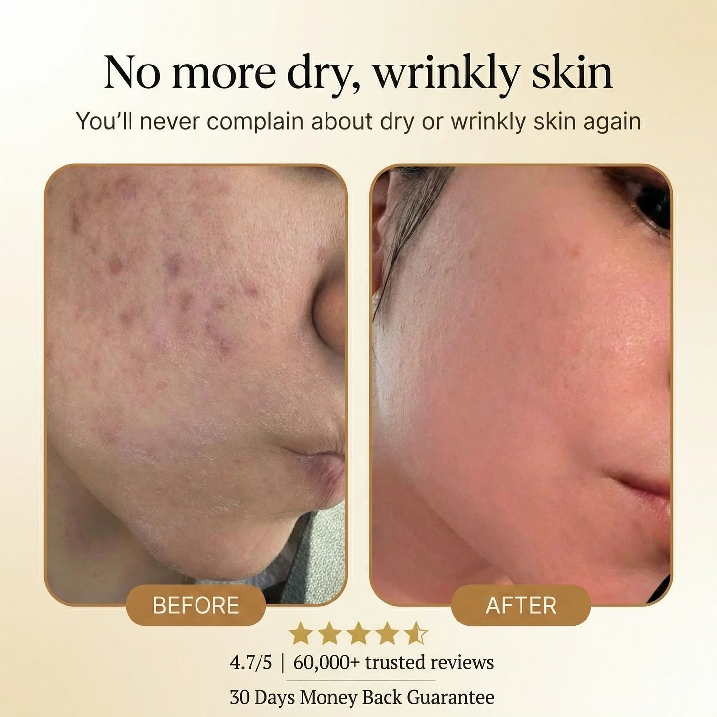 TopSpire Organic Tallow Honey Balm to Help Erase Fine Lines, Wrinkles, and Age Spots