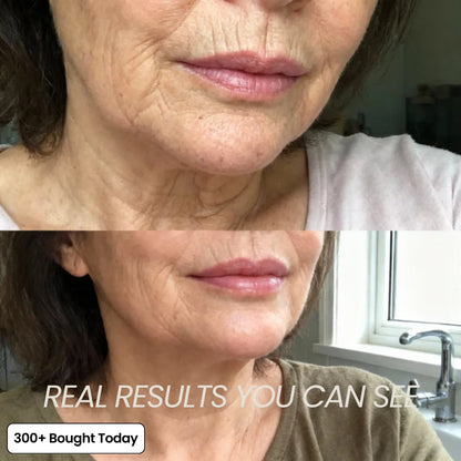 🔥LAST DAY 60% OFF OLIOKINDRED Korean Pink Collagen Volume Multi Balm