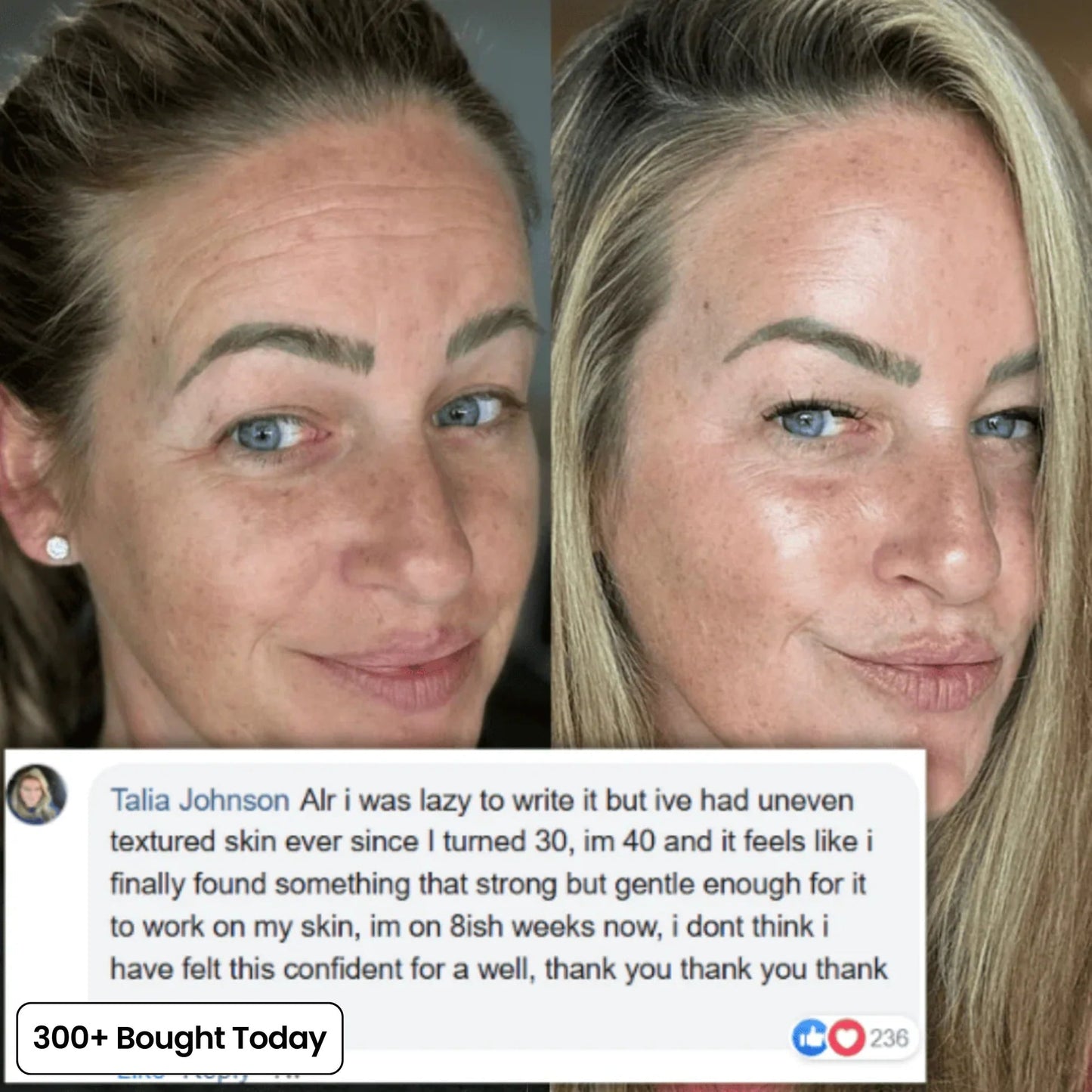 🔥LAST DAY 60% OFF OLIOKINDRED Korean Pink Collagen Volume Multi Balm