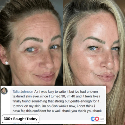 🔥LAST DAY 60% OFF OLIOKINDRED Korean Pink Collagen Volume Multi Balm