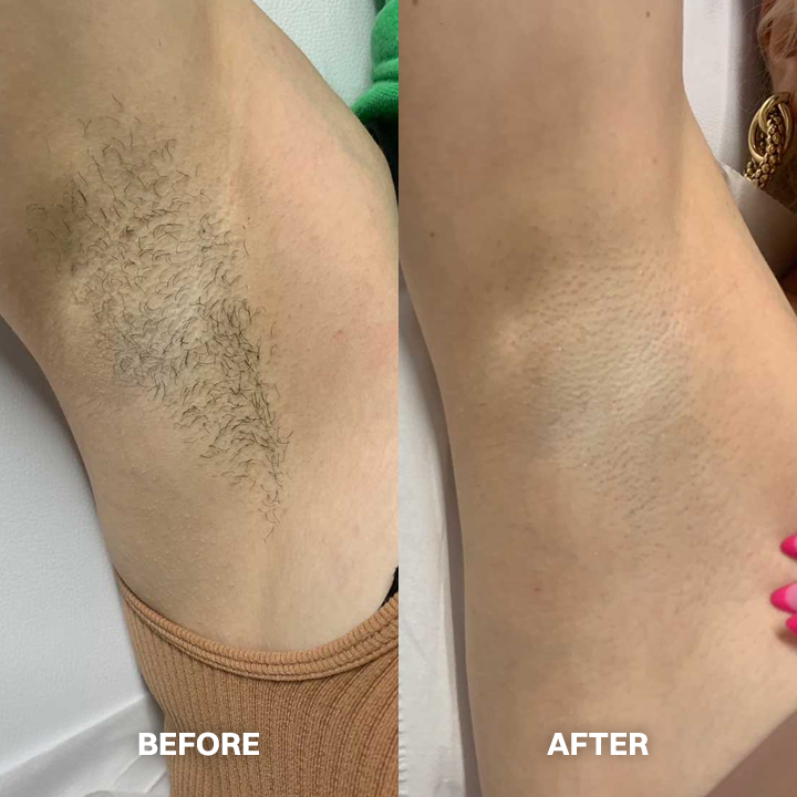 ✨ Hair Removal Cream for All Women & Men | Smooth, Silky Skin in Minutes ✨