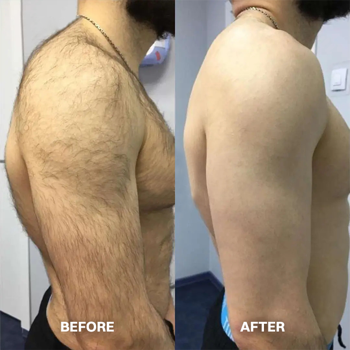 ✨ Hair Removal Cream for All Women & Men | Smooth, Silky Skin in Minutes ✨