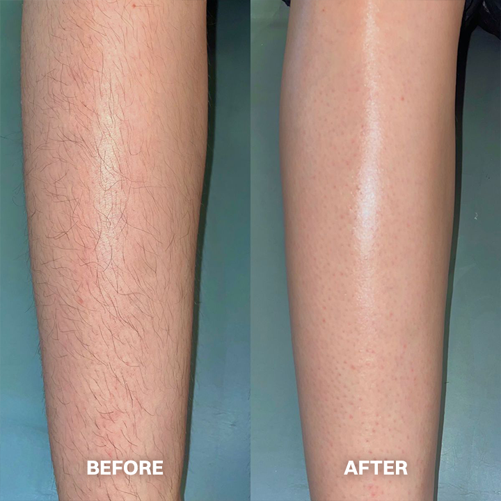 ✨ Hair Removal Cream for All Women & Men | Smooth, Silky Skin in Minutes ✨