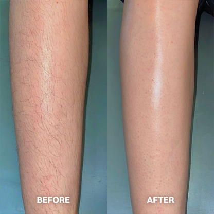 ✨ Hair Removal Cream for All Women & Men | Smooth, Silky Skin in Minutes ✨