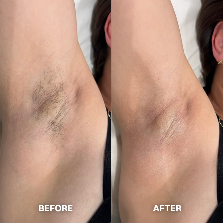 ✨ Hair Removal Cream for All Women & Men | Smooth, Silky Skin in Minutes ✨