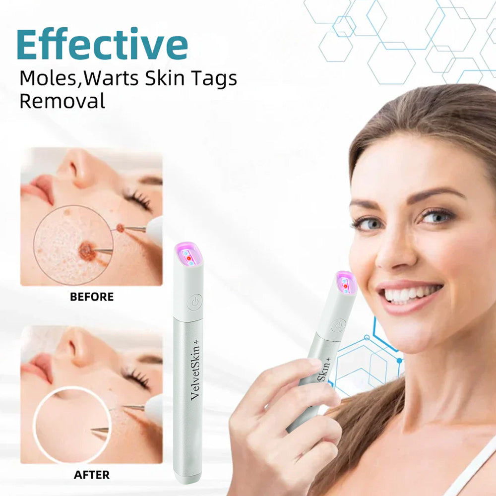 ✨All-in-One CO₂ Laser Eraser Pen | Removes Moles, Warts, Skin Flaws & Pigmentation