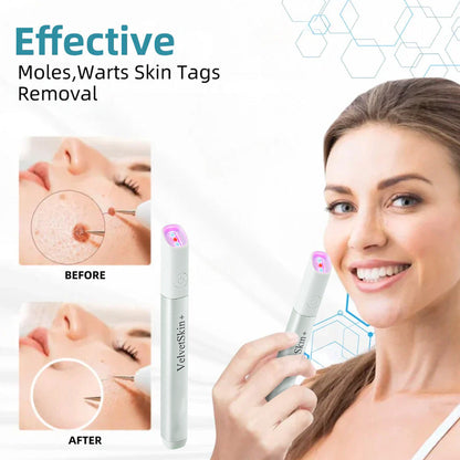 ✨All-in-One CO₂ Laser Eraser Pen | Removes Moles, Warts, Skin Flaws & Pigmentation
