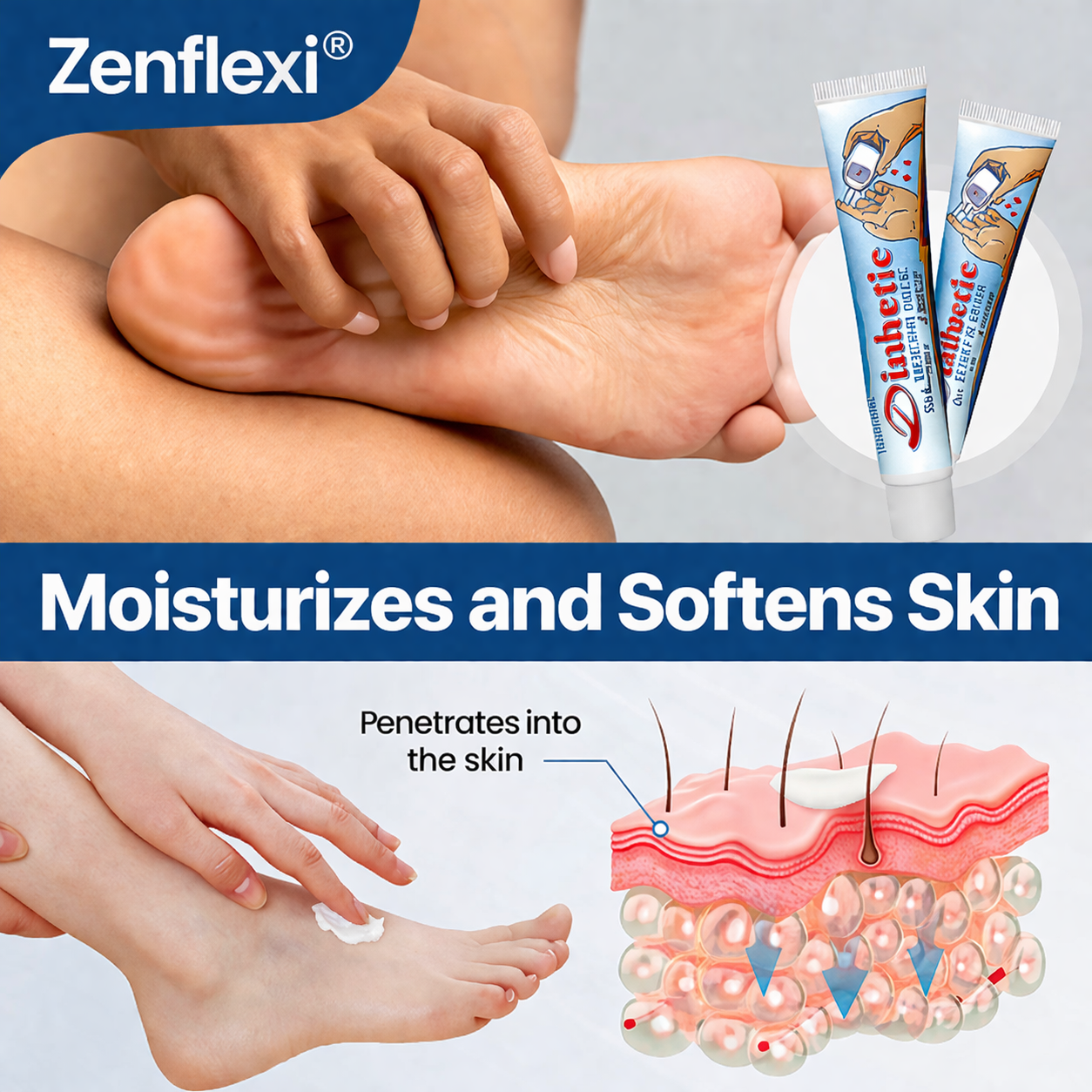 💙Zenflexi®Diabetes Treatment Cream