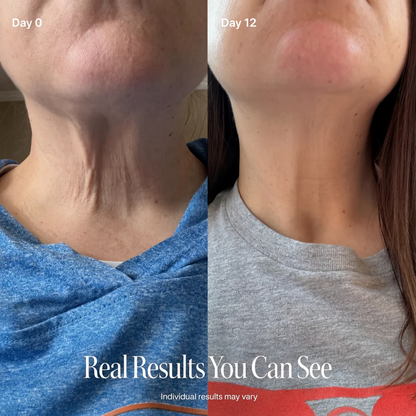 🔥Elmstr Contour Firming Cream&Advanced Hexapeptide Sculpting Formula