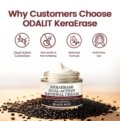 💎 Exclusive Offer | KeraErase Renewal Cream – Visible Skin Improvement