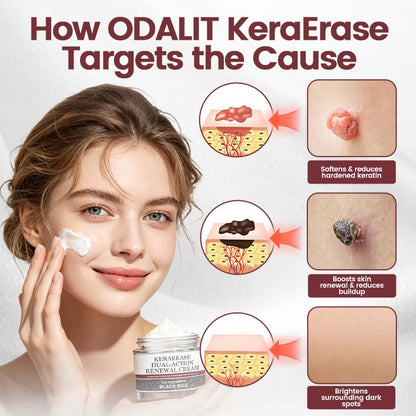 💎 Exclusive Offer | KeraErase Renewal Cream – Visible Skin Improvement
