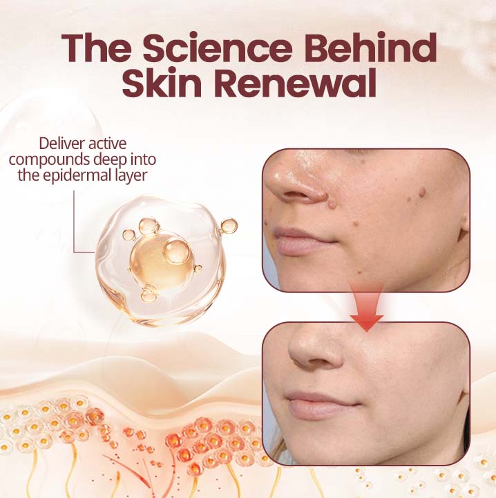 💎 Exclusive Offer | KeraErase Renewal Cream – Visible Skin Improvement