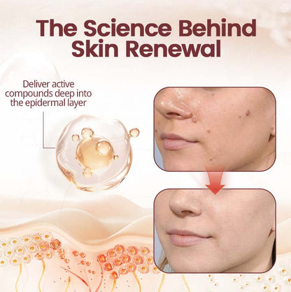 💎 Exclusive Offer | KeraErase Renewal Cream – Visible Skin Improvement